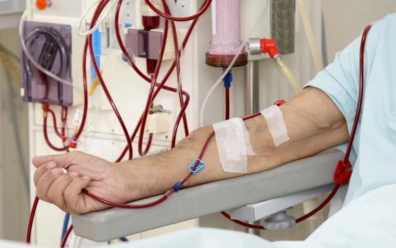 Обновление по гемодиализ-индуцированной мультиорганной ишемии (JASN, май 2024)