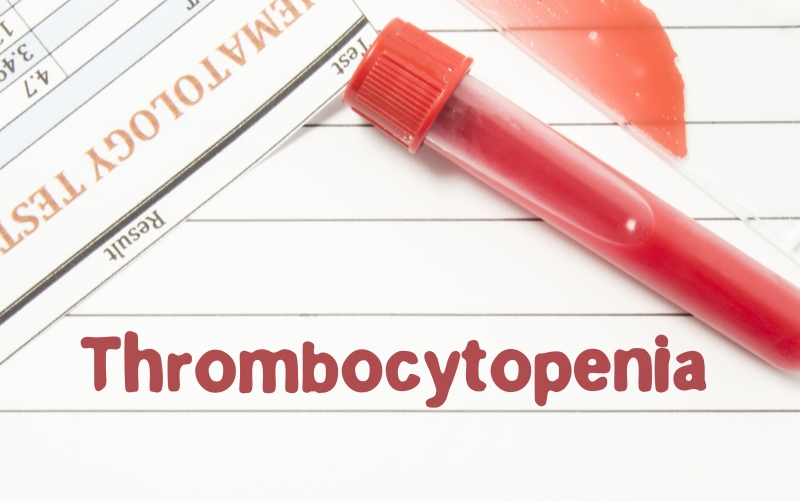 Как я диагностирую и лечу тромбоцитопению у пожилого пациента (Blood, ноябрь 2023)