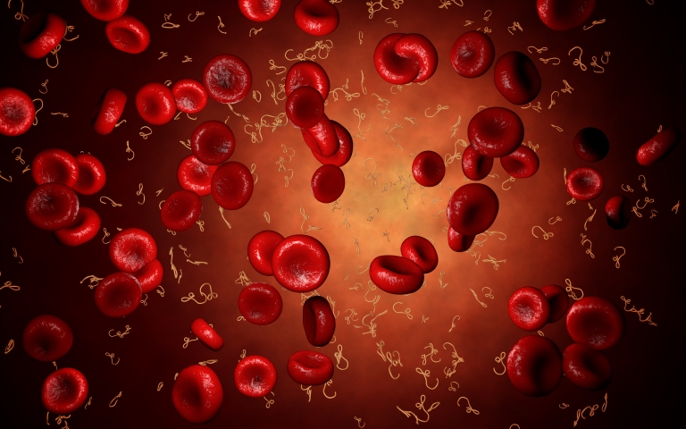 Миелодиспластические синдромы в эпоху геномной медицины (Blood, декабрь 2023)