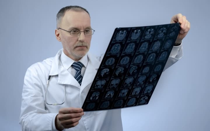 Руководство по профилактике судорог у взрослых, госпитализированных с черепно-мозговой травмой средней и тяжелой степени тяжести (Neurocritical Care Society, февраль 2024)