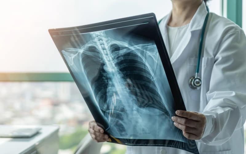 Руководство по физической терапии у пациентов с COVID-19 (Australian Physiotherapy Association, март 2020)