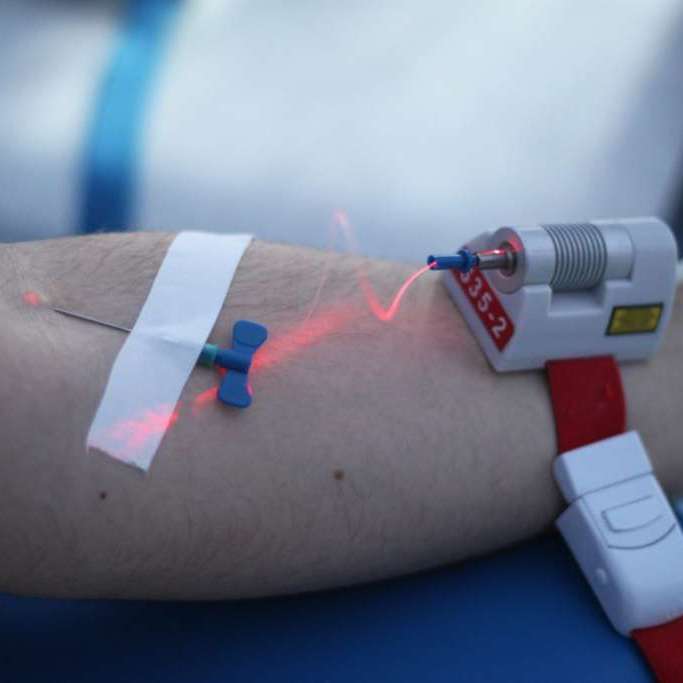 Лазерная чистка крови - 3 000 тг