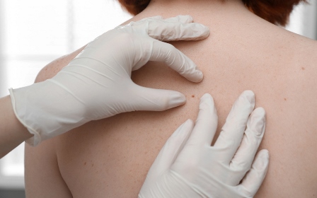 Меңдерді тексеріп, өміріңізді сақтаңыз