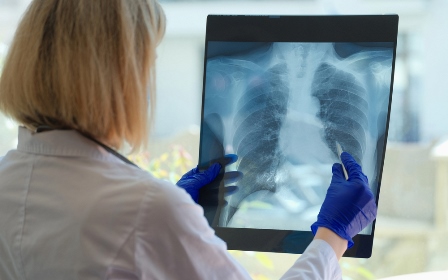 Что вы знаете о туберкулезе