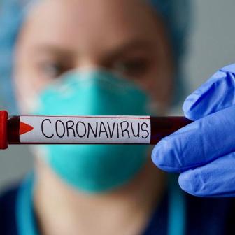 Часто задаваемые вопросы по коронавирусной инфекции