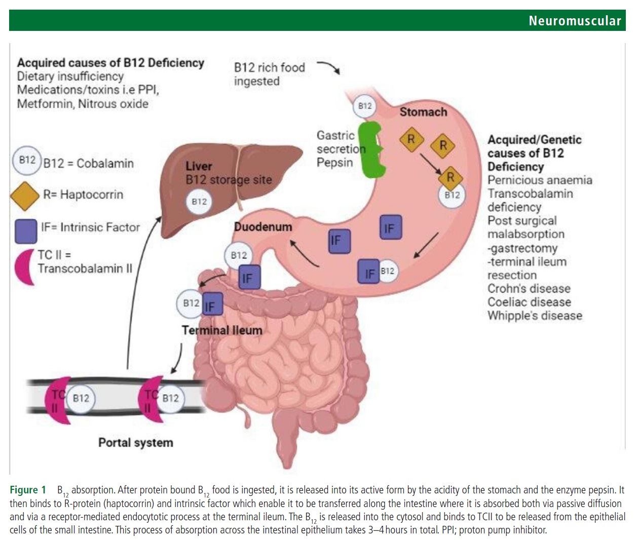 Нутрициональные периферические нейропатии (Journal of Neurology ...