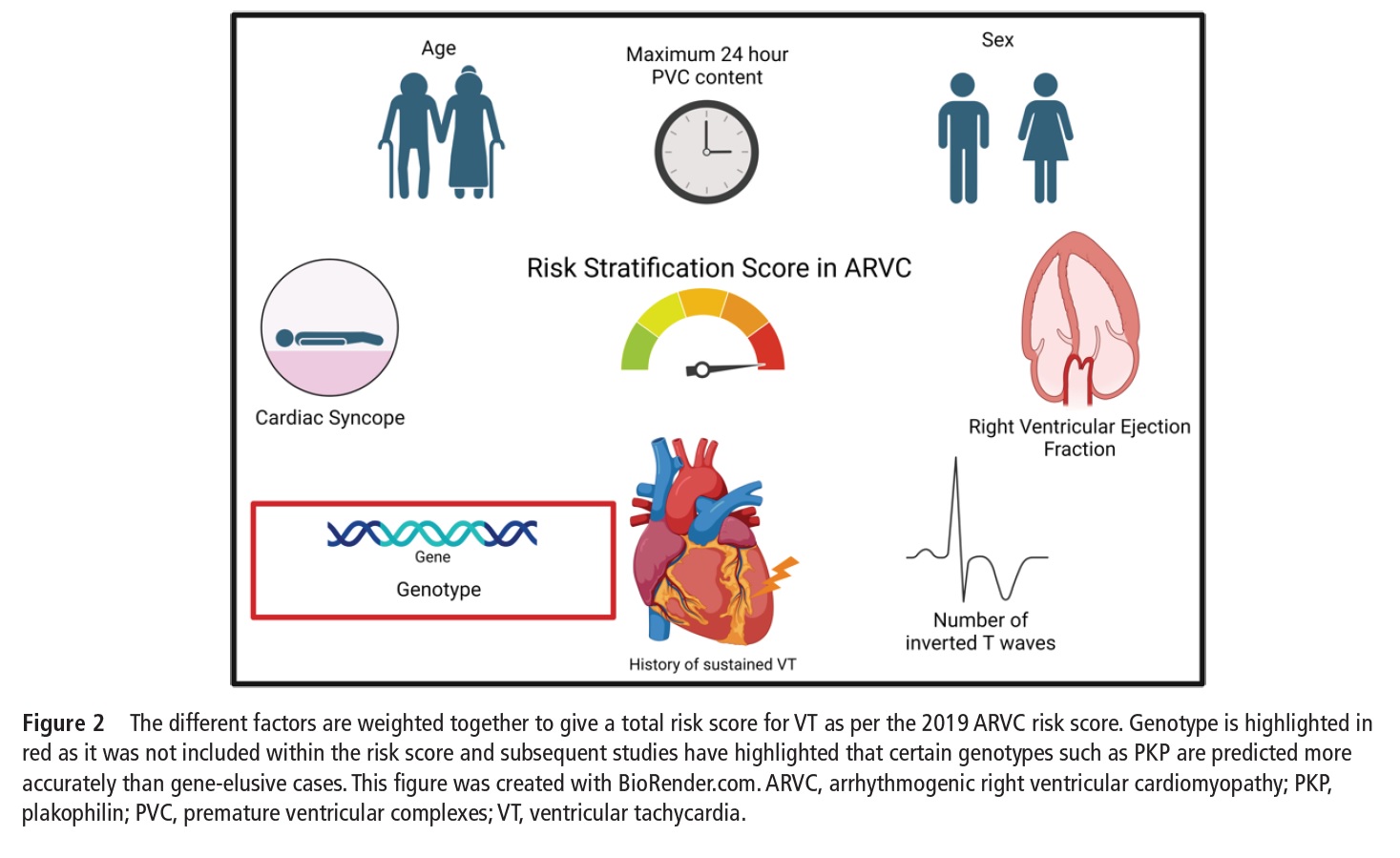 Лечение аритмогенной правожелудочковой кардиомиопатии (Heart, июль 2023 ...