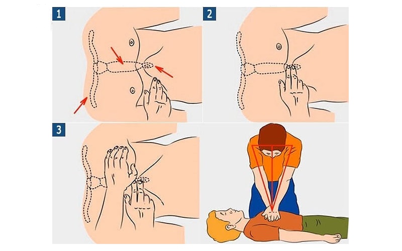 Как следует расположить руки на грудной. Непрямой массаж сердца техника выполнения. Как выполняется непрямой массаж сердца. Как правильно проводить непрямой массаж сердца. Правильное исполнение непрямого массажа сердца.