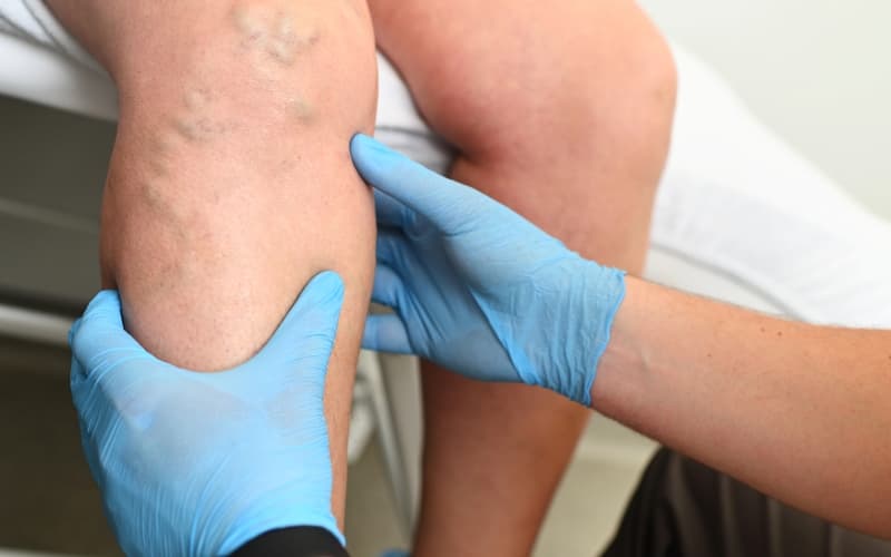 Флеболог: что за врач