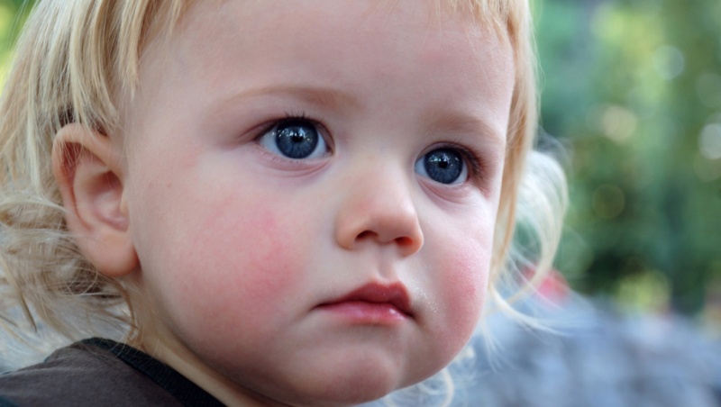 Аллергия у грудных детей: что делать?